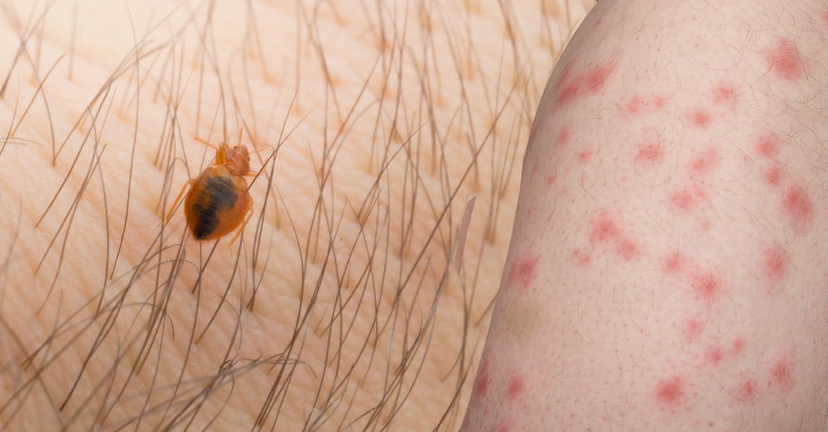 BED BUG BITES, HOW TO IDENTIFY AND TREATMENT